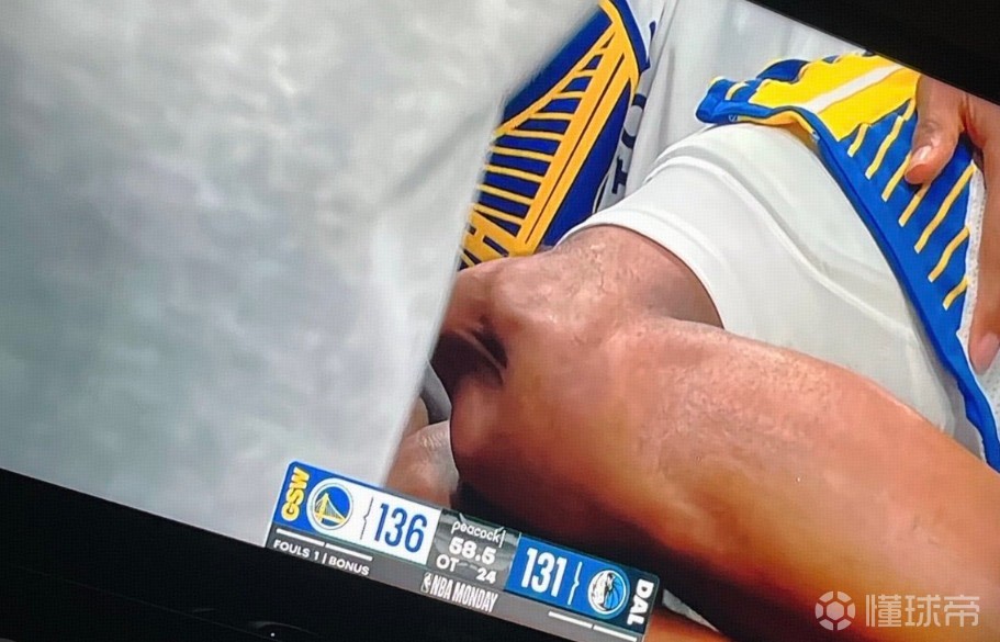 恐怖時刻！穆迪遭重傷膝蓋骨錯位突出明顯，轉播信號隨即切斷